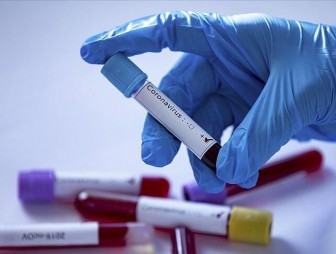 В Свислочском районе зарегистрирован 1 случай коронавирусной инфекции
