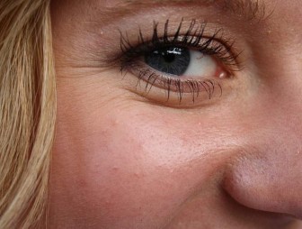 Почему появляются морщины под глазами – отвечает косметолог