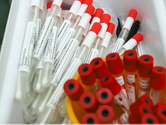Белорусские вирусологи могут выявлять новый штамм коронавируса «омикрон»