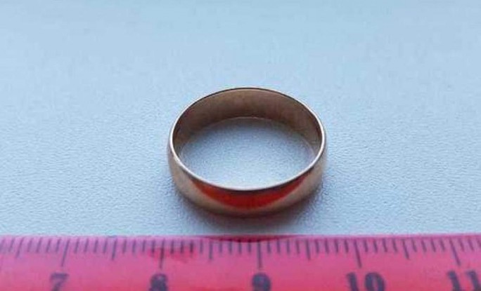 В Островецком районе годовалый мальчик проглотил обручальное кольцо