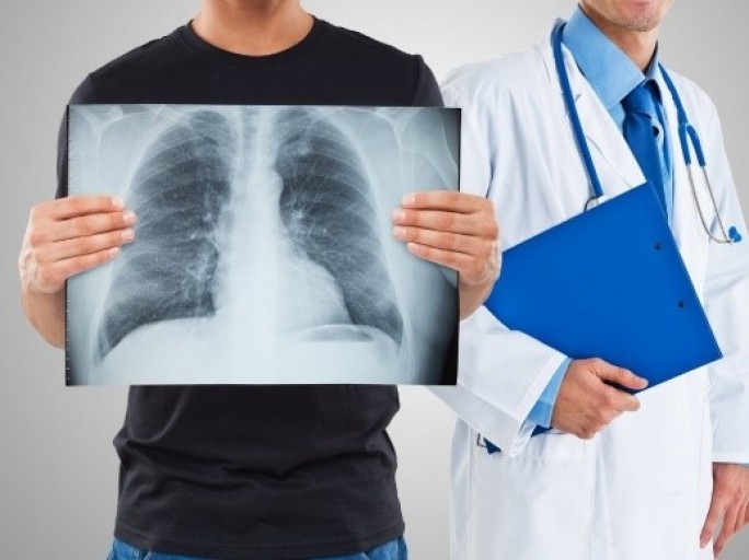 Флюорография необходима для здоровья ваших лёгких – советы специалиста